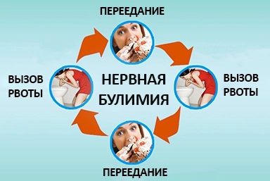 Лечение булимии в Рыбинске